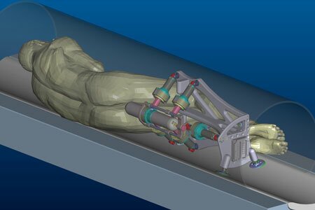 MrBot robot urologiczny