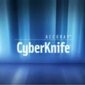 robot medyczny CyberKnife